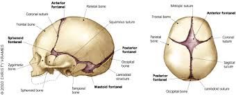 skull 2